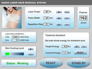 Cina Diode 810nm Laser Hair Removal Mesin permanen pemasok