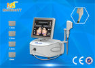 Cina Profesional High Intensity Focused Ultrasound HIFU Mesin Untuk Face Lift pabrik